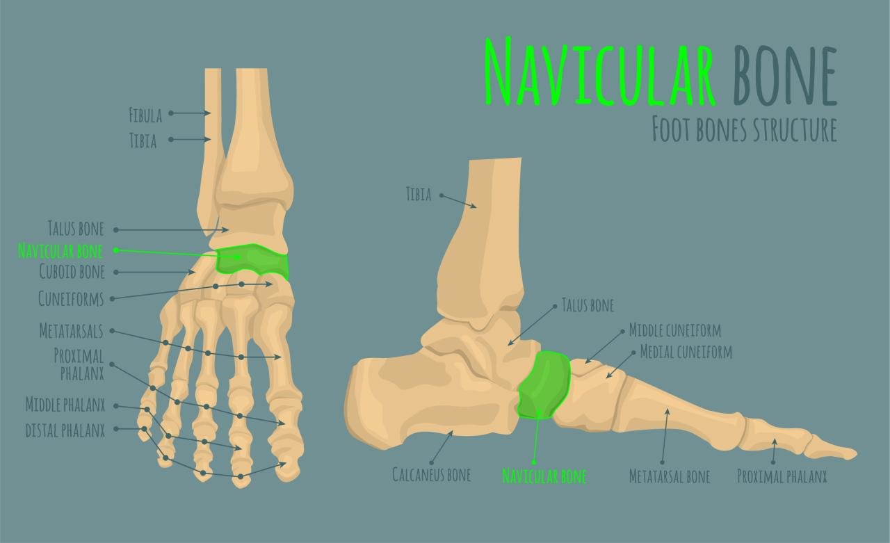 Accessory Navicular - Pediatrics - Orthobullets